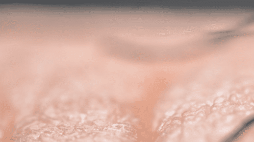 Residential solutions 4